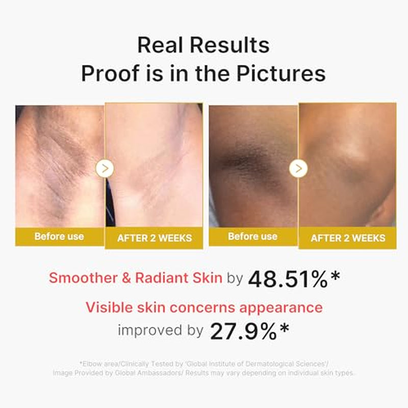 Kojic Acid Brightening Body Care Duo: Turmeric Body Peel Shot and Kojic Acid Body Wash | for Brightening, Exfoliating with Citrus Scent for Fresh Shower Routine